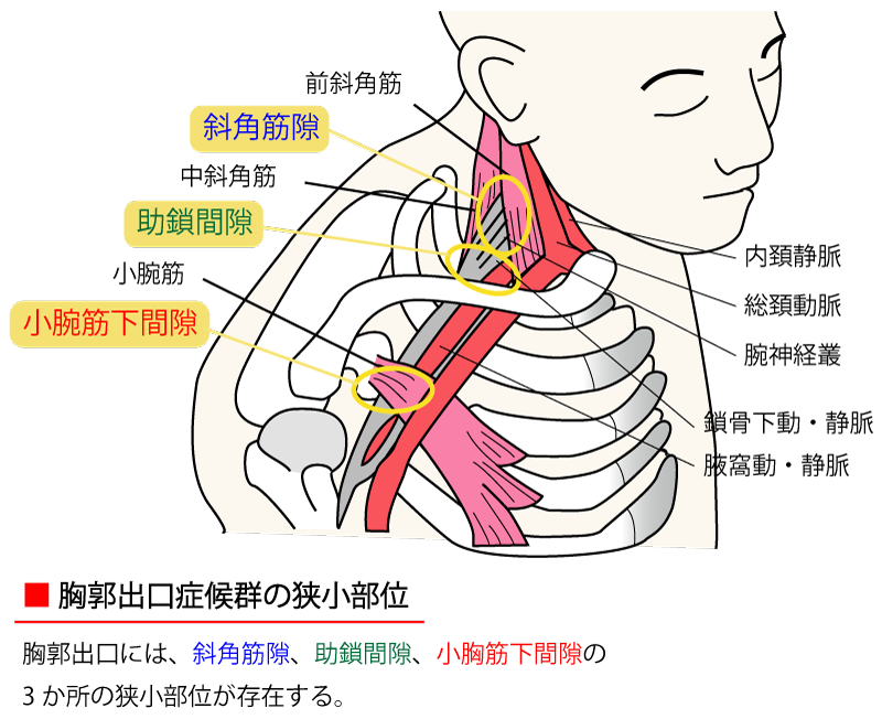 行田市で口コミ1位の胸郭出口症候群の施術 ひまわり鍼灸整骨院